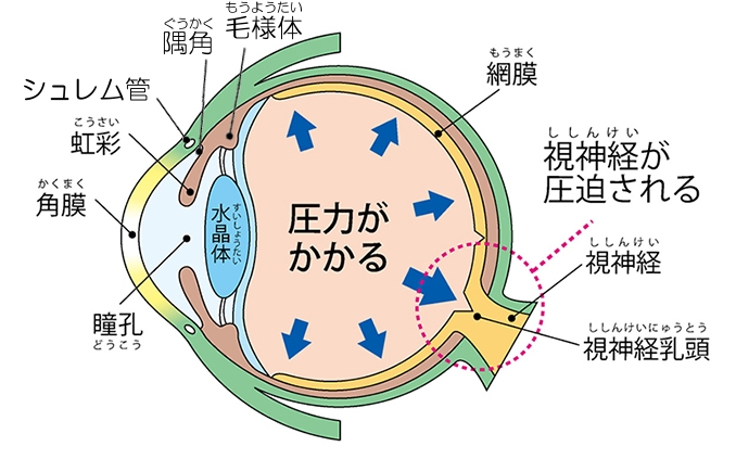 枚方市 大阪 で緑内障の検査 治療は南眼科まで